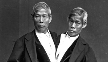 siamese twins